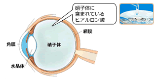 硝子体に含まれているヒアルロン酸