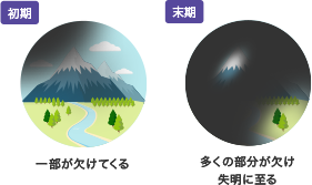 初期 末期