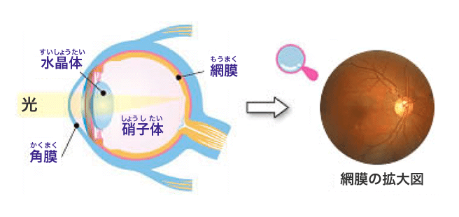 眼球と網膜に通る血管の図