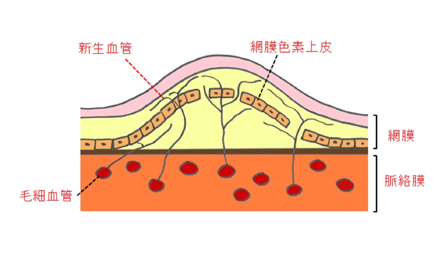 ゆがんで見える」「見たいところが見えない」加齢黄斑変性はセルフチェックで早期発見を！ | メノコト byわかさ生活