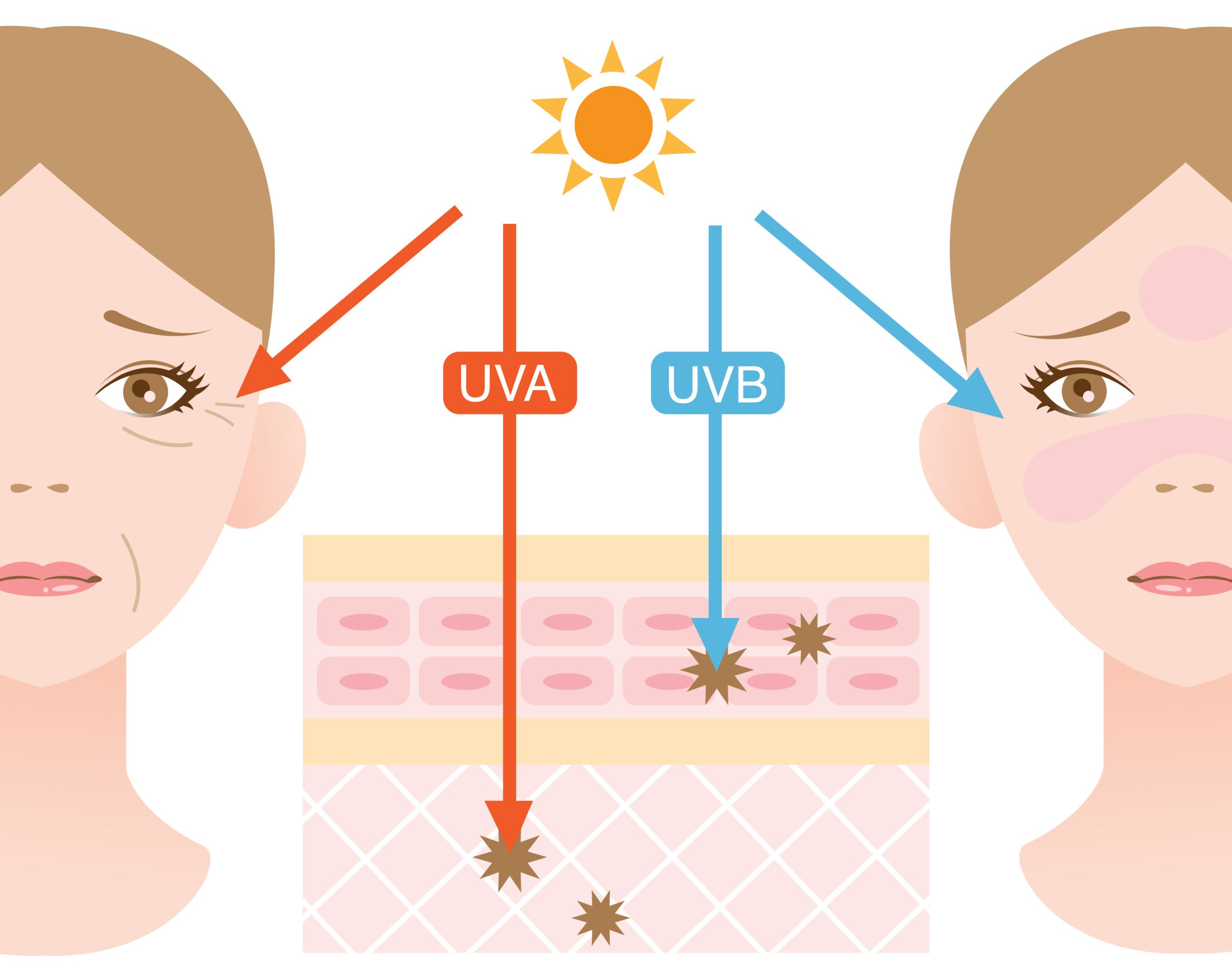 UV-ＡとUV-Bが肌に悪い影響を受けて困っている女性のイラスト