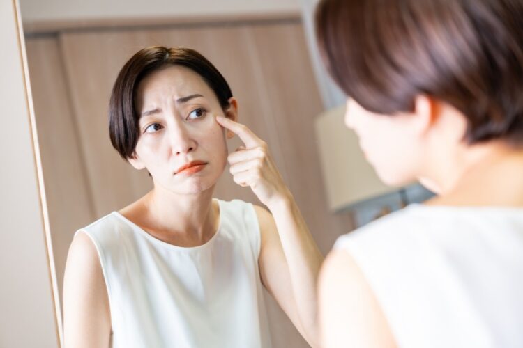 目元が気になる中年女性